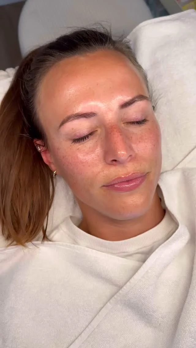 Warst du im Urlaub oder viel in der Sonne?
Hast du auch das Gefühl deine Haut ist verstopft von Sonnencreme und co?
Ist deine Haut beansprucht von viel Sonne oder so einfach trocken? 
Dann ist meine Aquafacial Behandlung genau das richtige für dich! Probiere es aus und überzeuge dich! 
Terminbuchung ganz einfach über Whats App 015129801567
#aquafaci̇al #gesichtsbehandlung #beautytreatments #facials #glassskin
